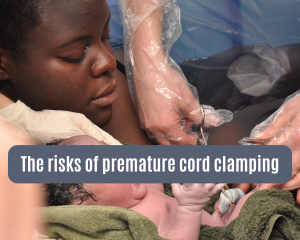 A mother and baby in a birth pool. The baby's umbilical cord is being clamped, ready to be cut.