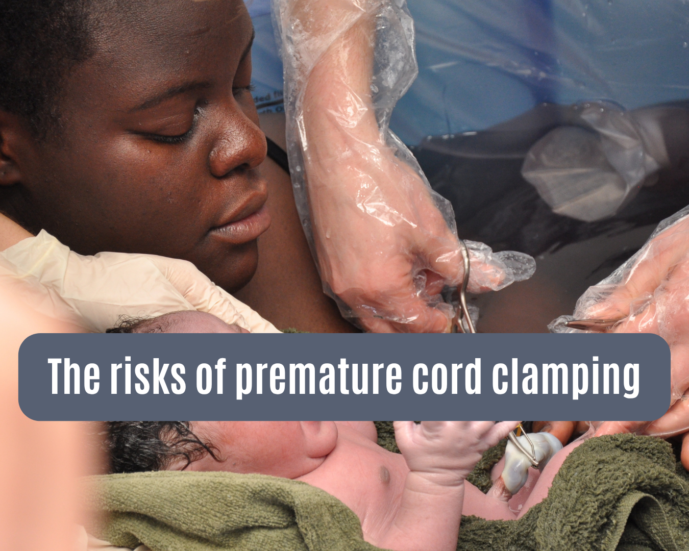 A mother and baby in a birth pool. The baby's umbilical cord is being clamped, ready to be cut.